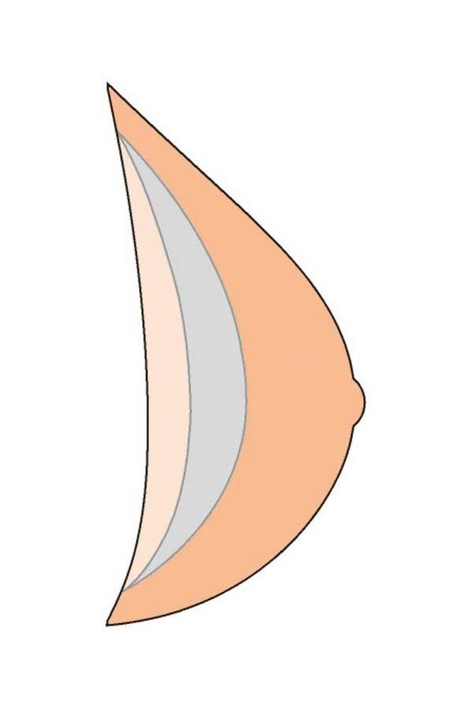 Breast Form with Comfort P1667